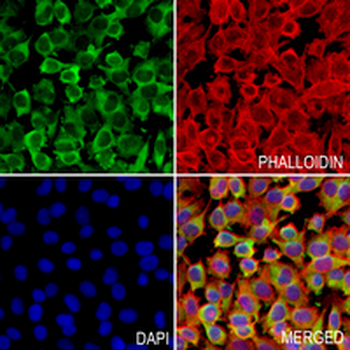 STAU1 Rabbit Monoclonal Antibody
