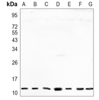 RPS20 Rabbit Monoclonal Antibody