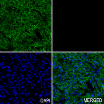 RPS20 Rabbit Monoclonal Antibody