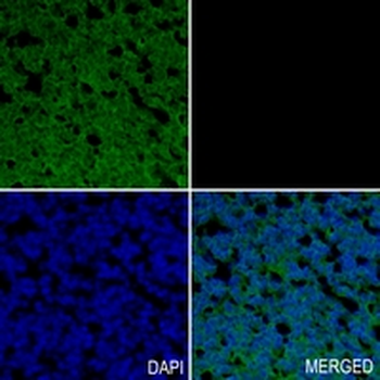 BDNF Rabbit Monoclonal Antibody