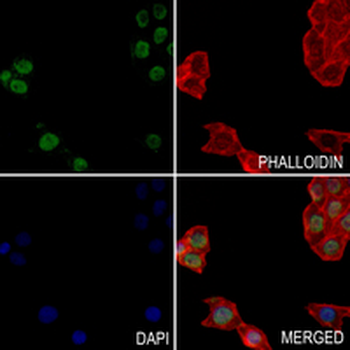 TFIIF RAP 30 Rabbit Monoclonal Antibody