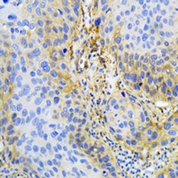 Caveolin 1 Rabbit Monoclonal Antibody