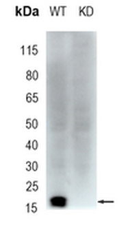 Caveolin 1 Rabbit Monoclonal Antibody
