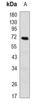 TGFBI Rabbit Monoclonal Antibody