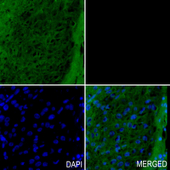 TGFBI Rabbit Monoclonal Antibody