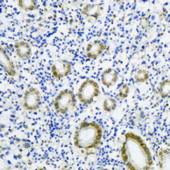 SUN2 Rabbit Monoclonal Antibody