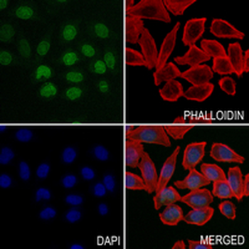 SUN2 Rabbit Monoclonal Antibody
