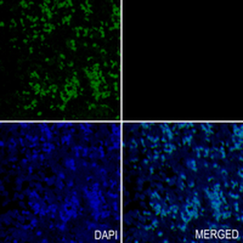 PIN4 Rabbit Monoclonal Antibody