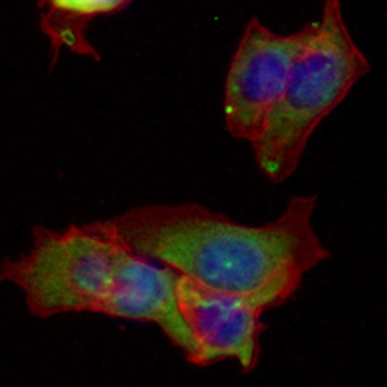 Periostin Rabbit Monoclonal Antibody
