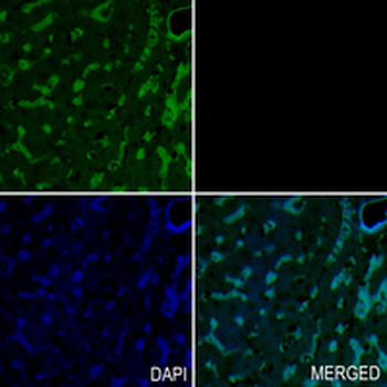 ACC alpha/beta Rabbit Monoclonal Antibody