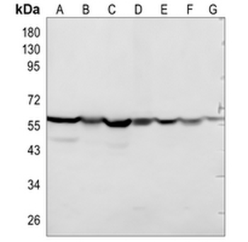 CCT2 Rabbit Monoclonal Antibody