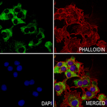 RPL10A Rabbit Monoclonal Antibody
