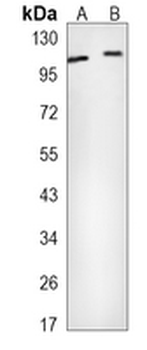 Alpha E-catenin Rabbit Monoclonal Antibody
