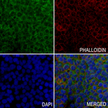 AK4 Rabbit Monoclonal Antibody