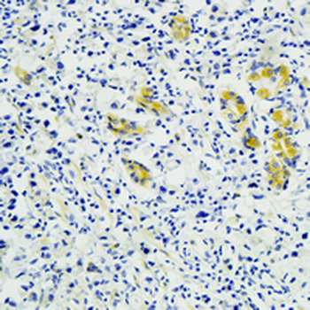 MFN2 Rabbit Monoclonal Antibody