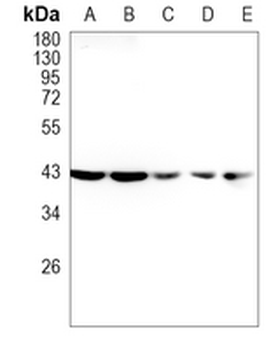 CCR7 Rabbit Monoclonal Antibody