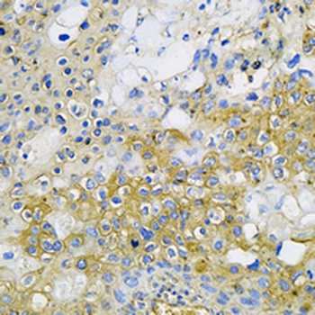CCR7 Rabbit Monoclonal Antibody