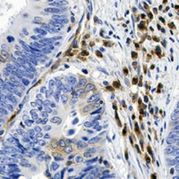 VIPR1 Rabbit Monoclonal Antibody