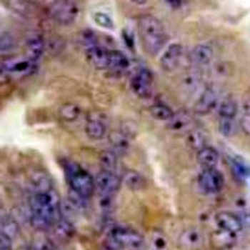 URI1 Rabbit Monoclonal Antibody