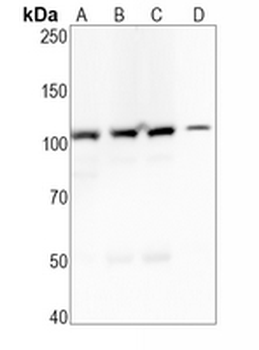 MSH2 Rabbit Monoclonal Antibody