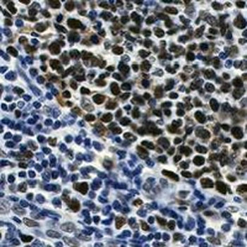 MSH2 Rabbit Monoclonal Antibody