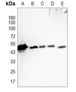 Cytokeratin 20 Rabbit Monoclonal Antibody