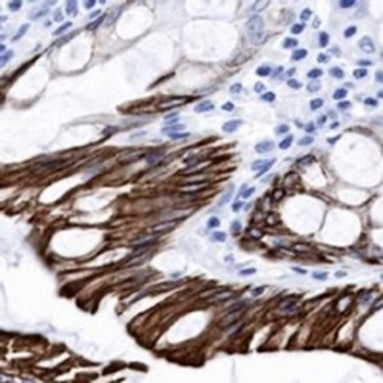 Cytokeratin 20 Rabbit Monoclonal Antibody