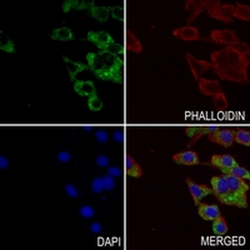 Cytokeratin 20 Rabbit Monoclonal Antibody