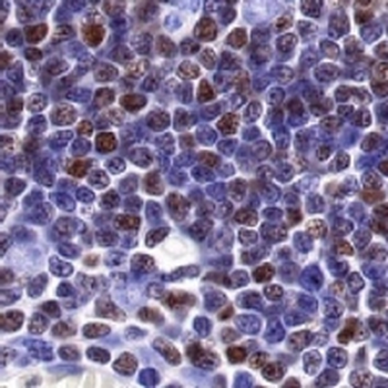 Ikaros Rabbit Monoclonal Antibody
