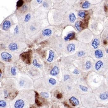 PIP Rabbit Monoclonal Antibody