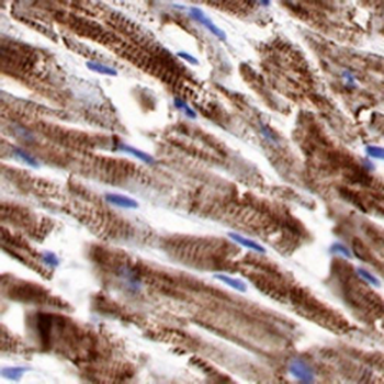 Desmin Rabbit Monoclonal Antibody
