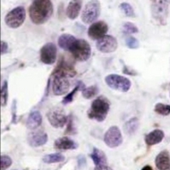 PARP1 (Cleaved-D214) Rabbit Monoclonal Antibody