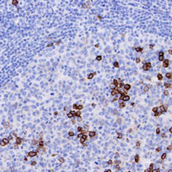 CD38 Rabbit Monoclonal Antibody