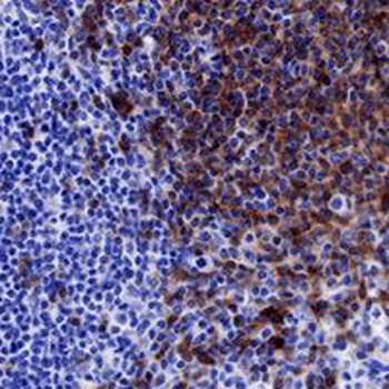 CD22 Rabbit Monoclonal Antibody