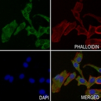 CD11b Rabbit Monoclonal Antibody