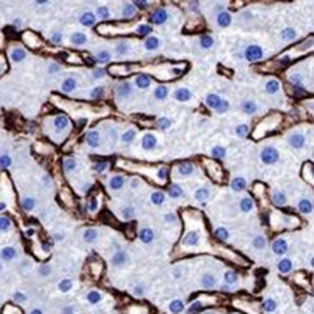 Caveolin 1 Rabbit Monoclonal Antibody