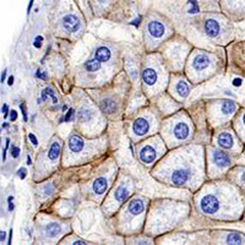 E Cadherin Rabbit Monoclonal Antibody