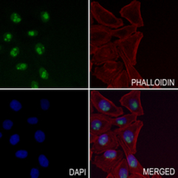 Ki67 Rabbit Monoclonal Antibody