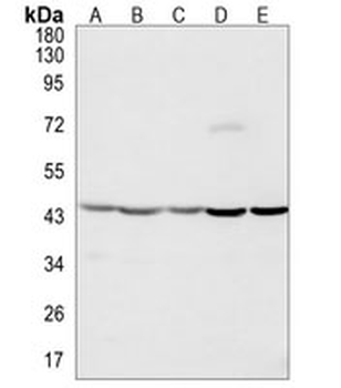 Beta-actin Rabbit Monoclonal Antibody