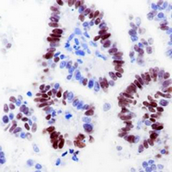 CD8a Rabbit Monoclonal Antibody