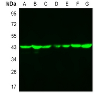 Goat Anti-Rabbit IgG (H&L) Antibody (AcalephFluor790)
