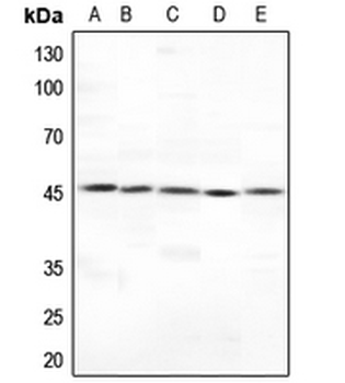 Cytokeratin 18 Rabbit Polyclonal Antibody