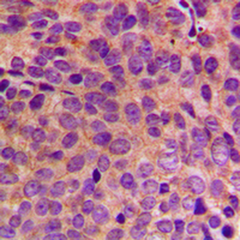 Cytokeratin 18 Rabbit Polyclonal Antibody