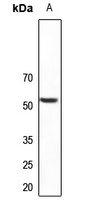 PLXDC1 Rabbit Polyclonal Antibody