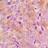 DNA Polymerase gamma 2 Rabbit Polyclonal Antibody