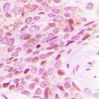 POLR2E Rabbit Polyclonal Antibody