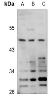 POTEA Rabbit Polyclonal Antibody