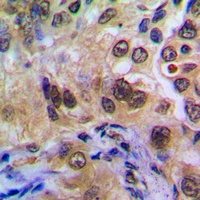 POTEA Rabbit Polyclonal Antibody