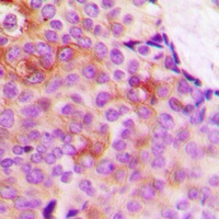 DARPP32 (Phospho-T75) Rabbit Polyclonal Antibody