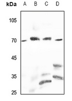 PPP2R5D Rabbit Polyclonal Antibody